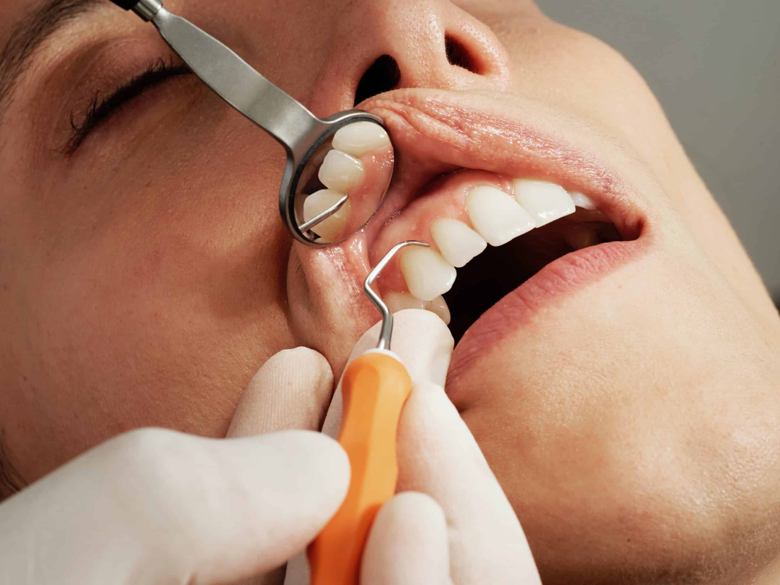 Olathe Sedation Dentistry