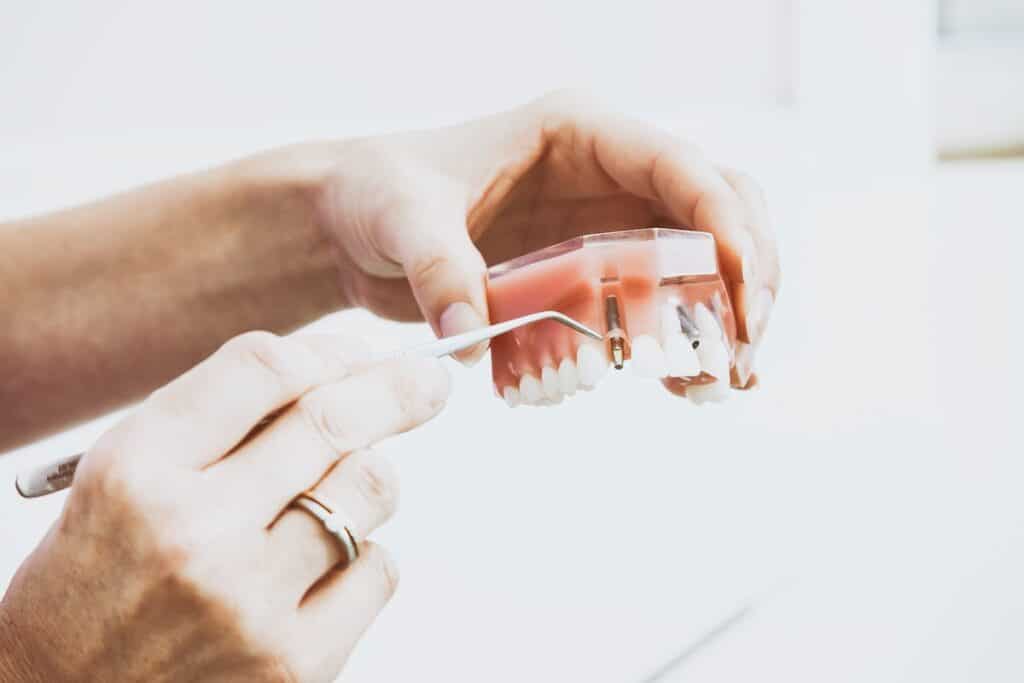 implant placement and restorations.