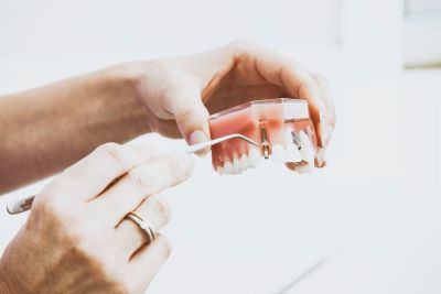 cosmetic dentistry for cracked tooth