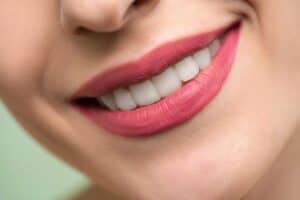 Preventing dental erosion with Your Olathe Dentist