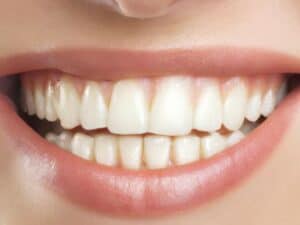 DIY Teeth Whitening Tips