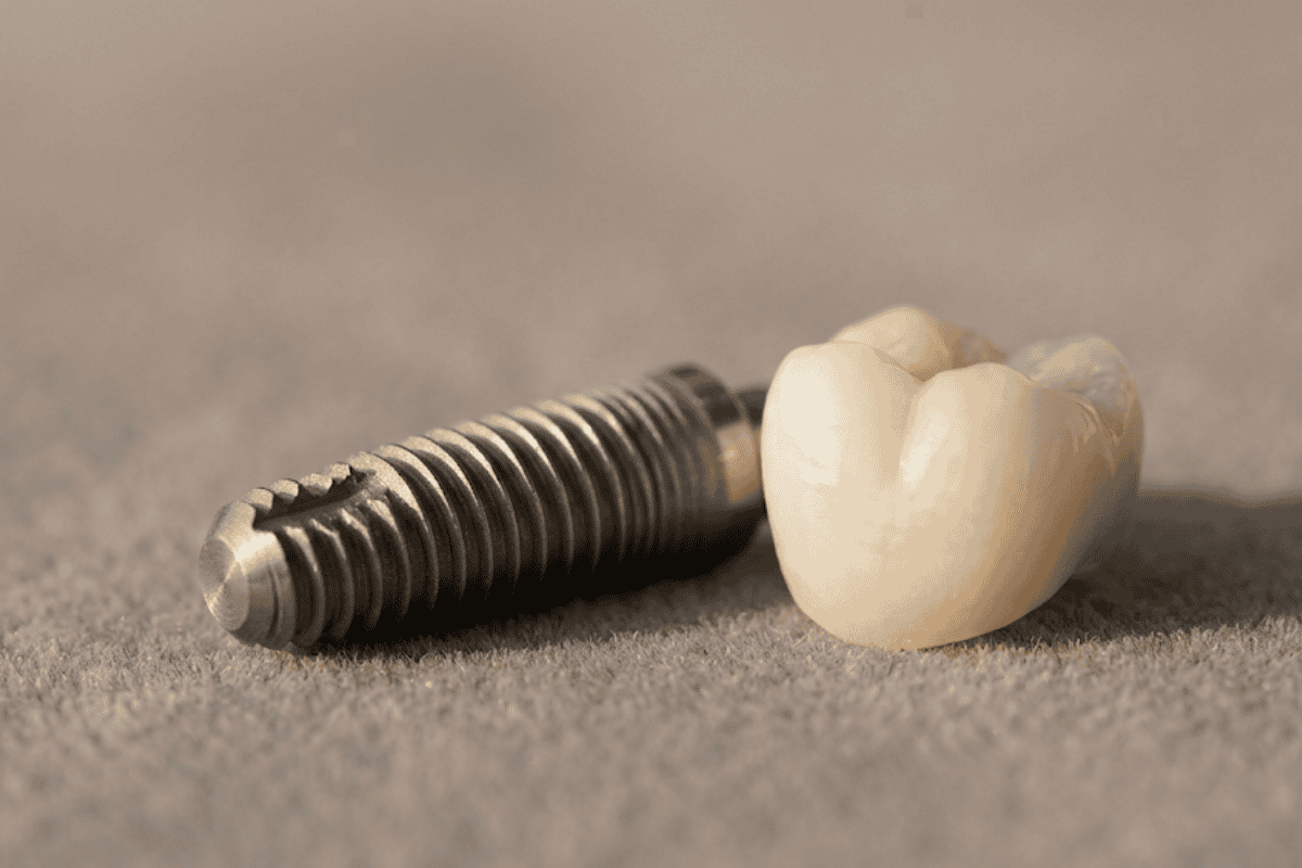 Close-up of a metal dental implant screw next to a natural-looking tooth crown on a neutral surface.