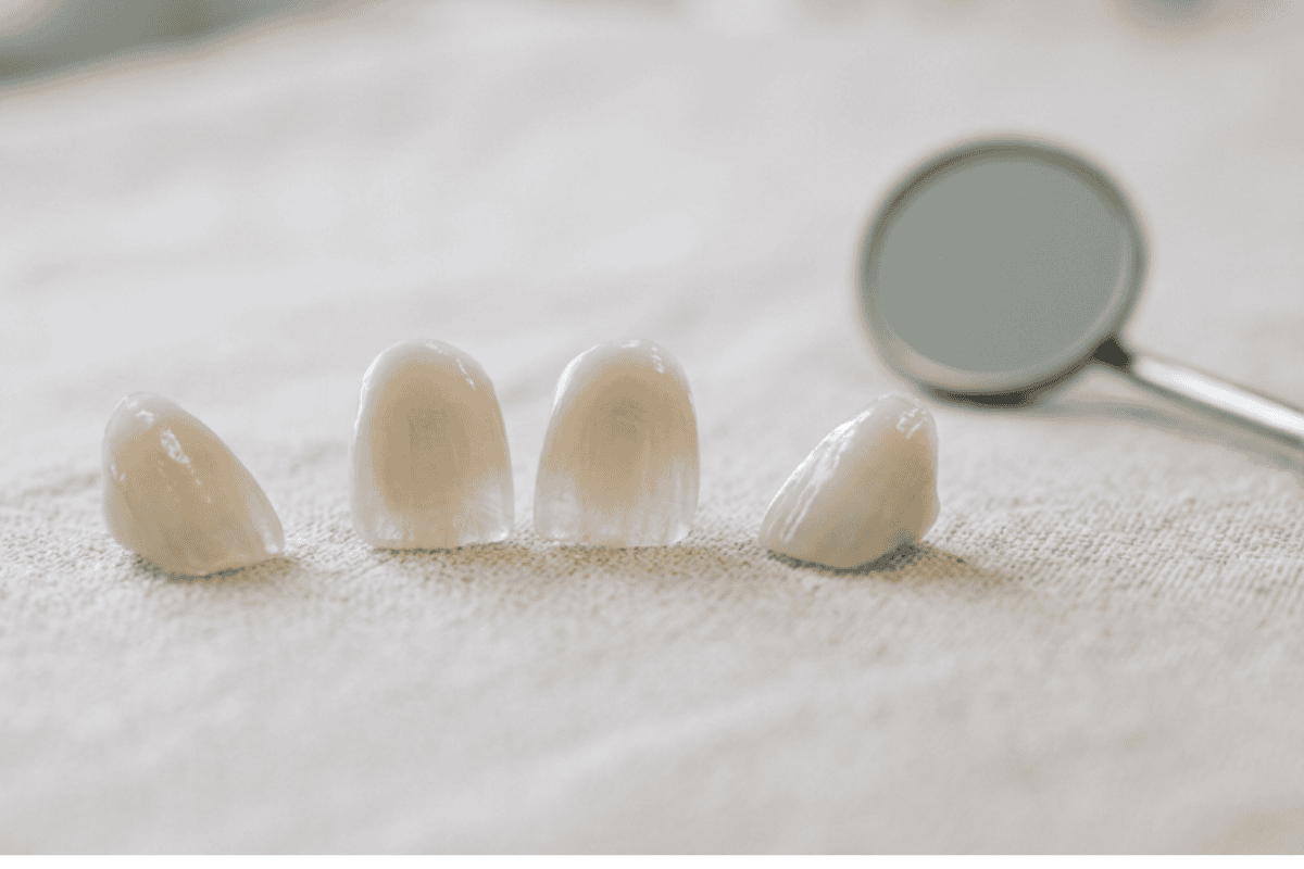 Four dental veneers lined up on a light fabric with a dental mirror in the blurred background.
