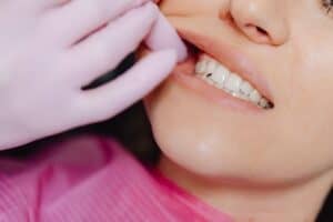 Olathe Sleep Bruxism Treatment - Olathe Dentist | Your Olathe Dentist Olathe Family Dentist